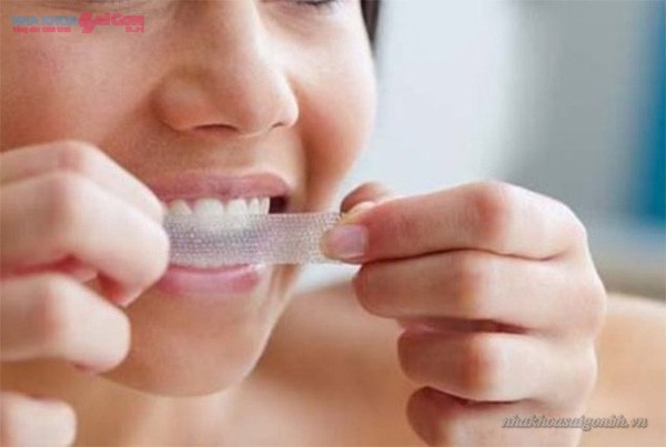 tay trang rang bang mieng dan cresd 3d 21 Những phương pháp tẩy trắng răng tại nhà hiệu quả