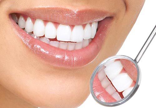 Tẩy trắng răng có thực sự hữu ích không?